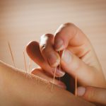 Healing with Acupuncture