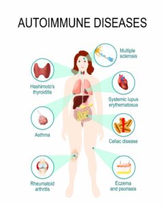 Therapies for a Healthy Immune System By Dr. Kathy Veon